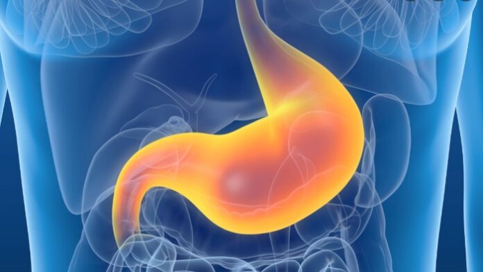 Hazımsızlığa ne iyi gelir