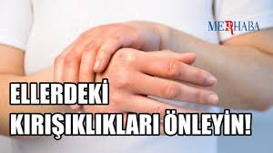 Ellerdeki Kırışıklık Nasıl Geçer? Ellerdeki Kırışıklıklar Nasıl Giderilir?