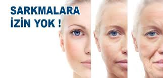 Yüz Sarkması Nasıl Geçer? Doğal Yöntemler ve Maskeler