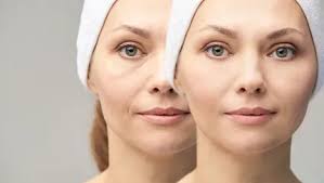 Botoks Etkisi Olan Yüz Maskesi Tarifleri